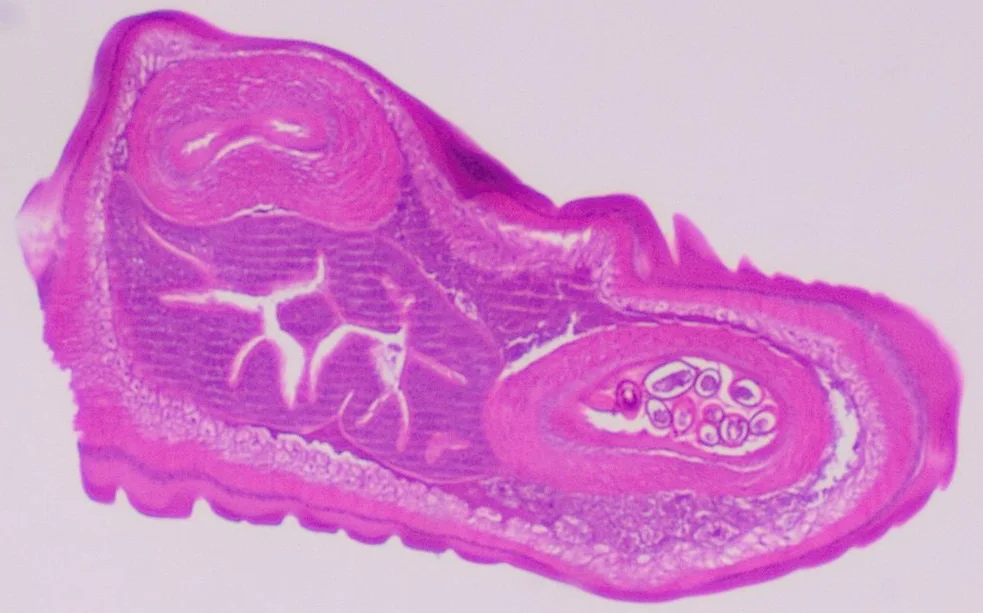 Cross-section of whipworm on microscopy, original