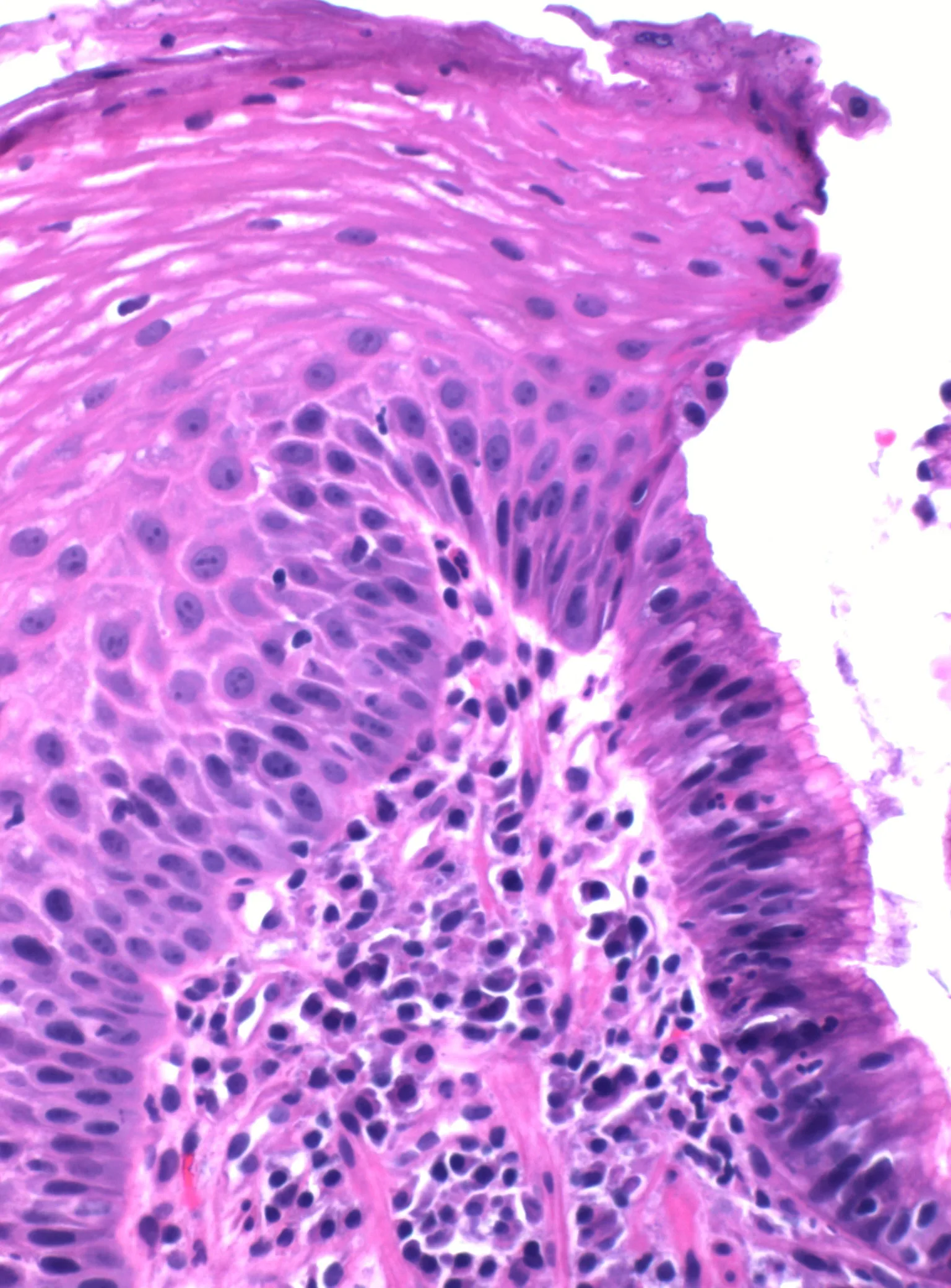 Histopathology of the gastro-esophageal junction