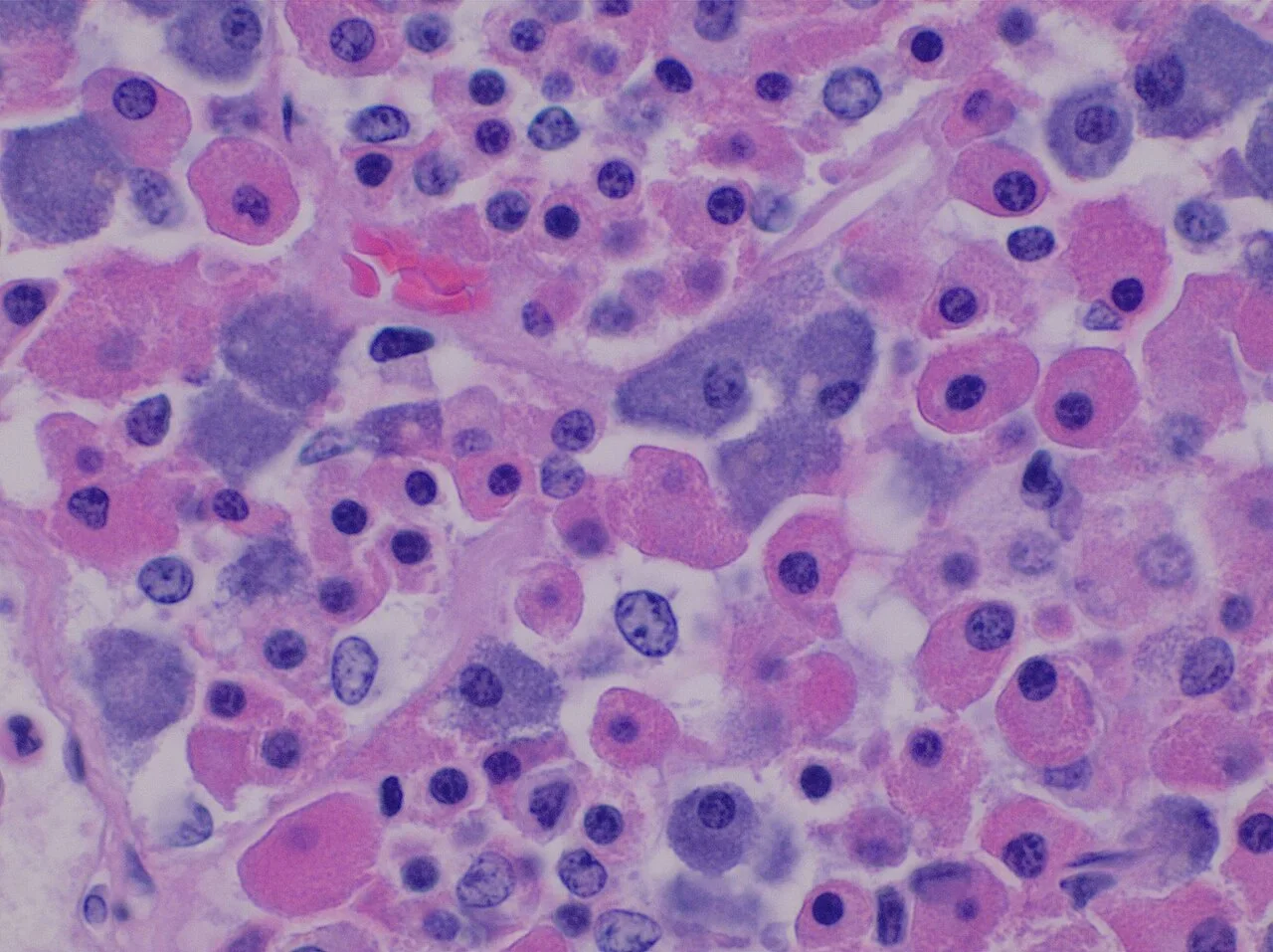 Histology of pars distalis of the anterior pituitary with chromophobes, basophils, and acidophils