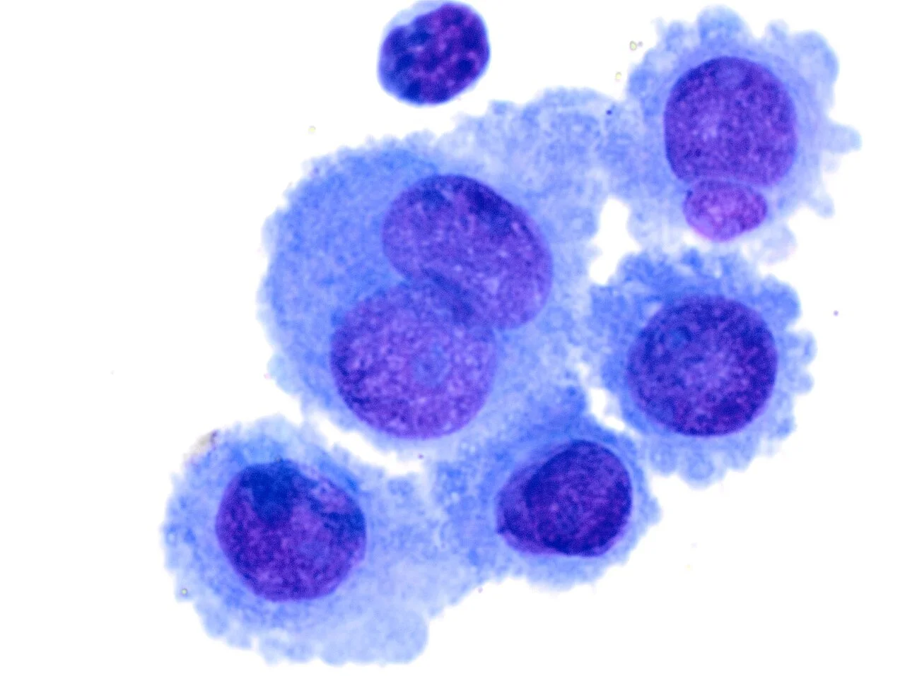 Cytology of normal mesothelium, original