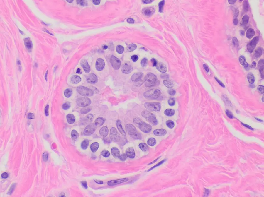 Normal breast acinus