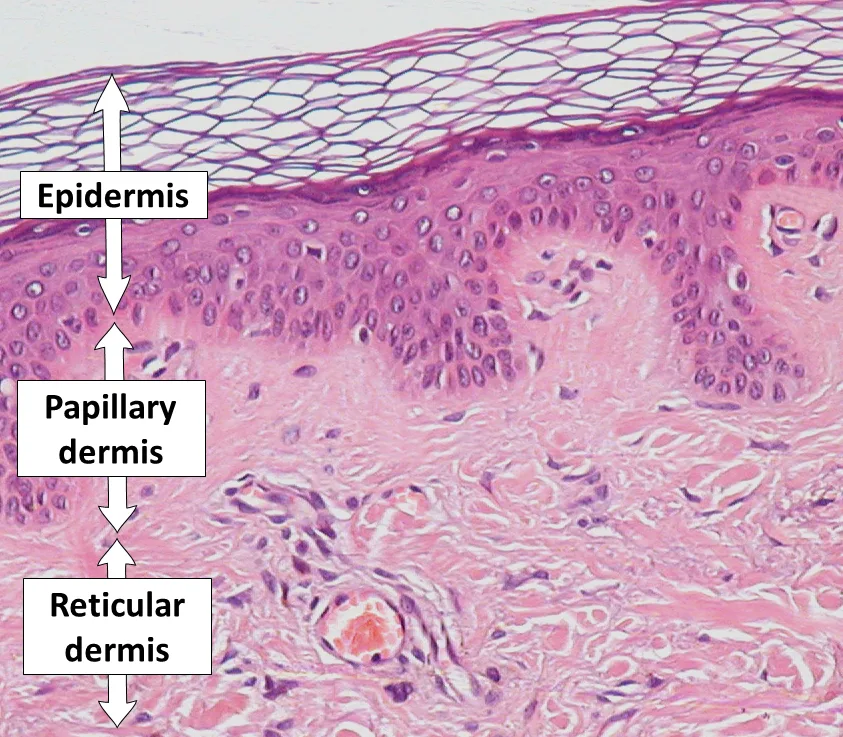 Epidermis, papillary dermis and reticular dermis