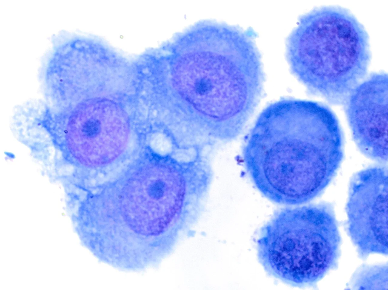 Cytology of reactive mesothelium, original