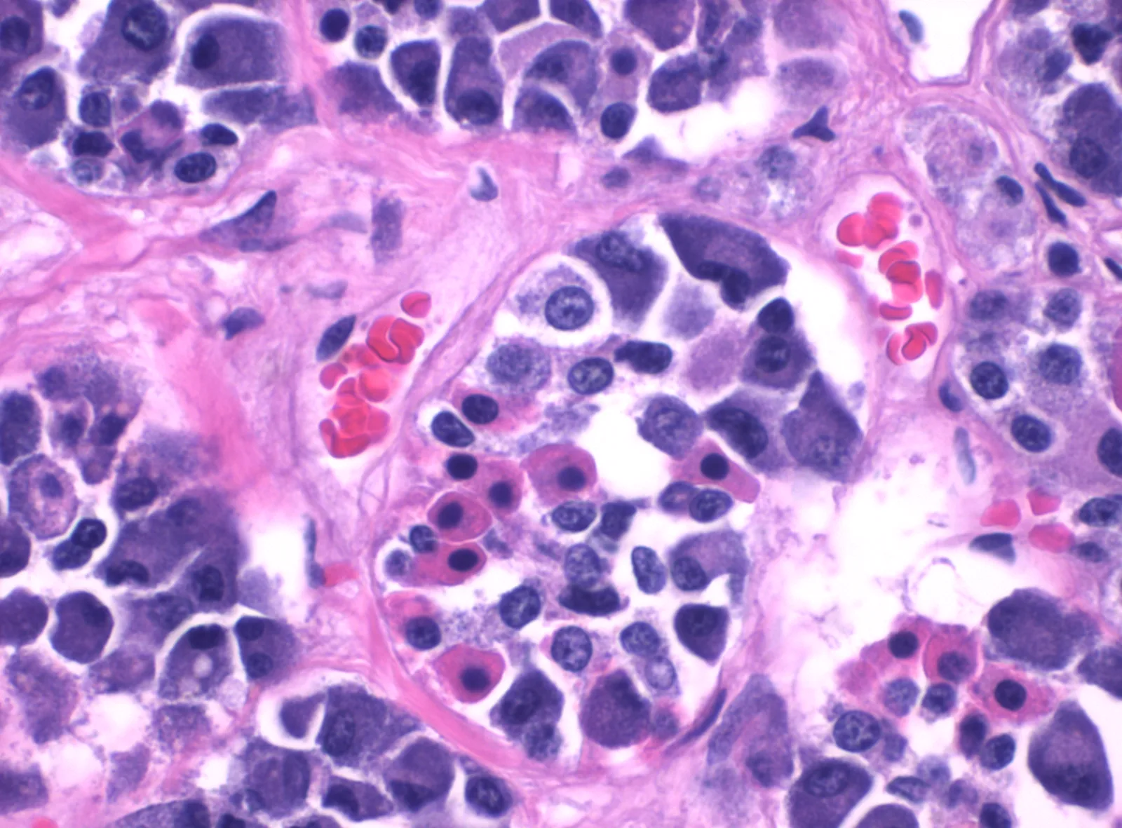 High magnification histology of pars distalis of the anterior pituitary gland