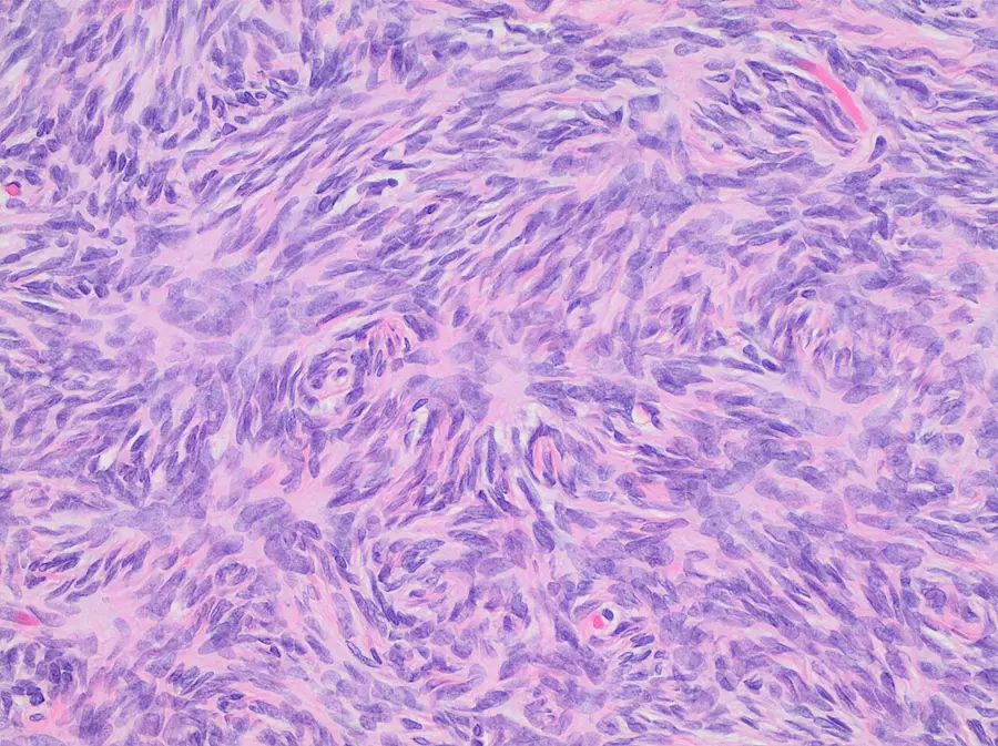 Histology of ovarian stroma