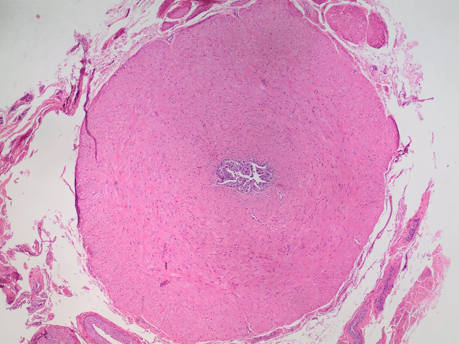 Histology of vas deferens