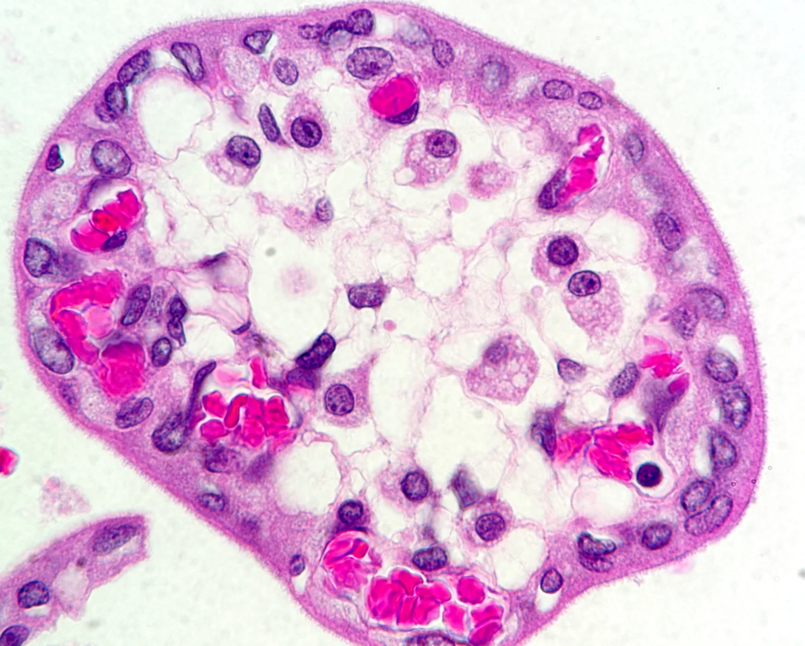 Chorionic villus with Hofbauer cells