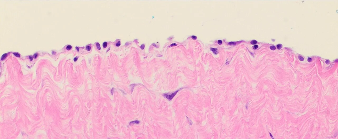 Histology of the mesothelial lining of a hernia sac