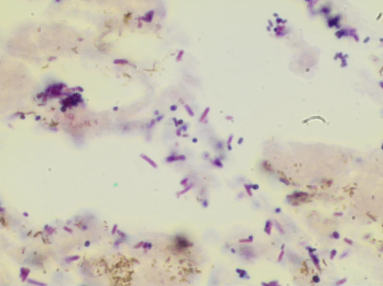 Gram negative rods and gram positive cocci 1