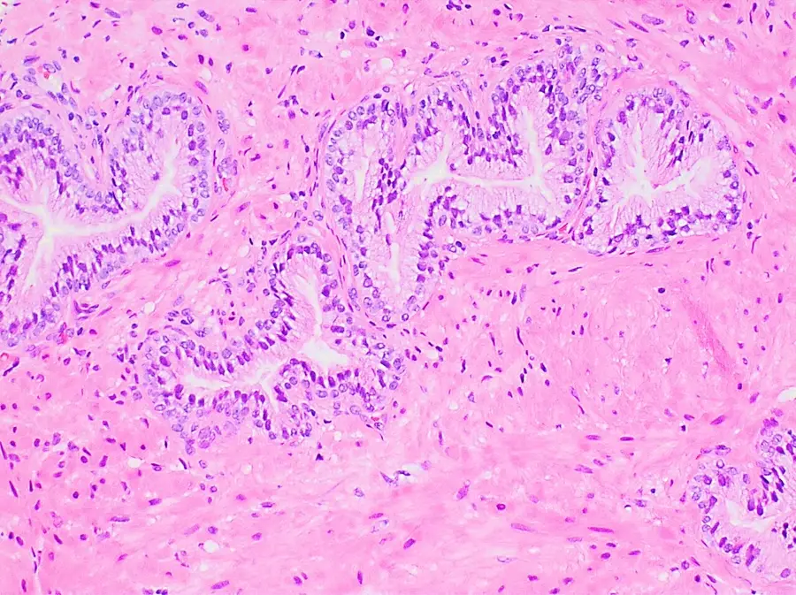 Histology of normal prostate
