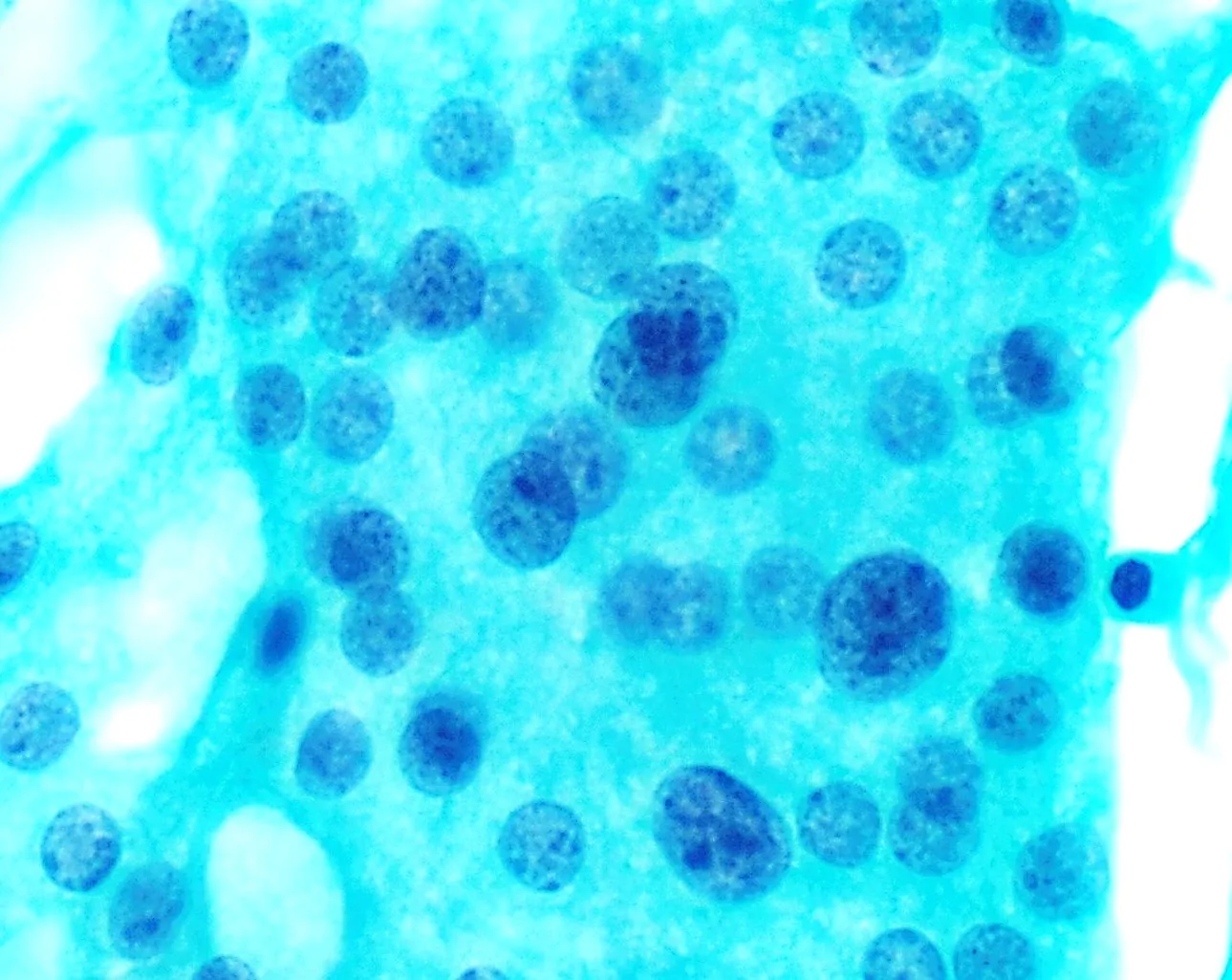 Cytology of benign follicular epithelial cells (thyroid)