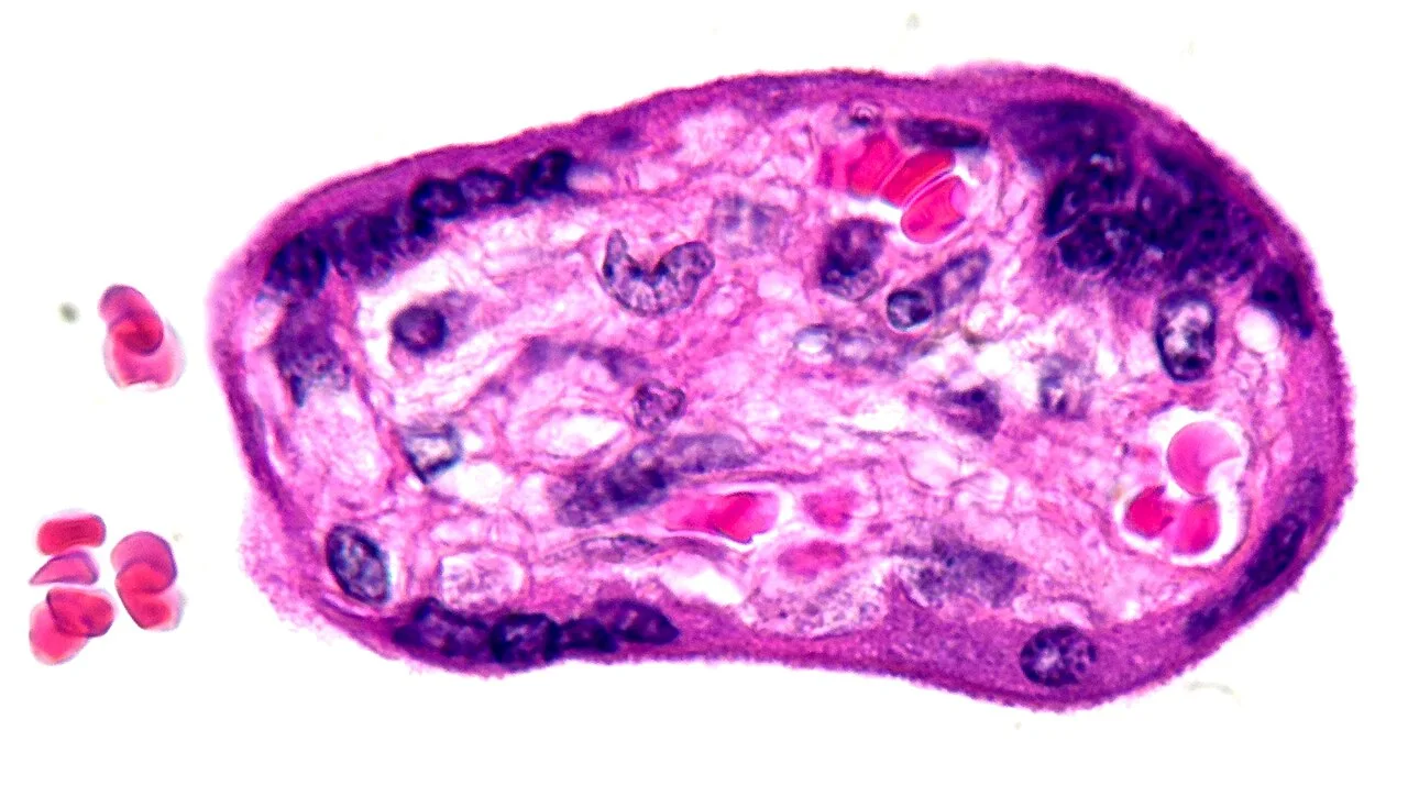 Histology of chorionic villus at term