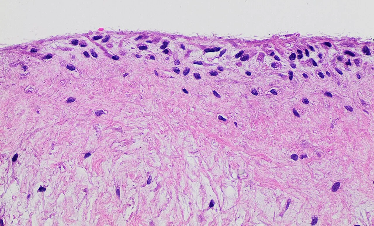Histology of synovial membrane