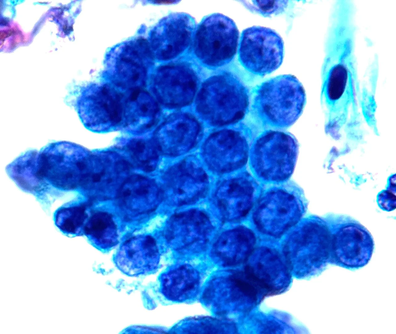Endocervical cells on Pap test