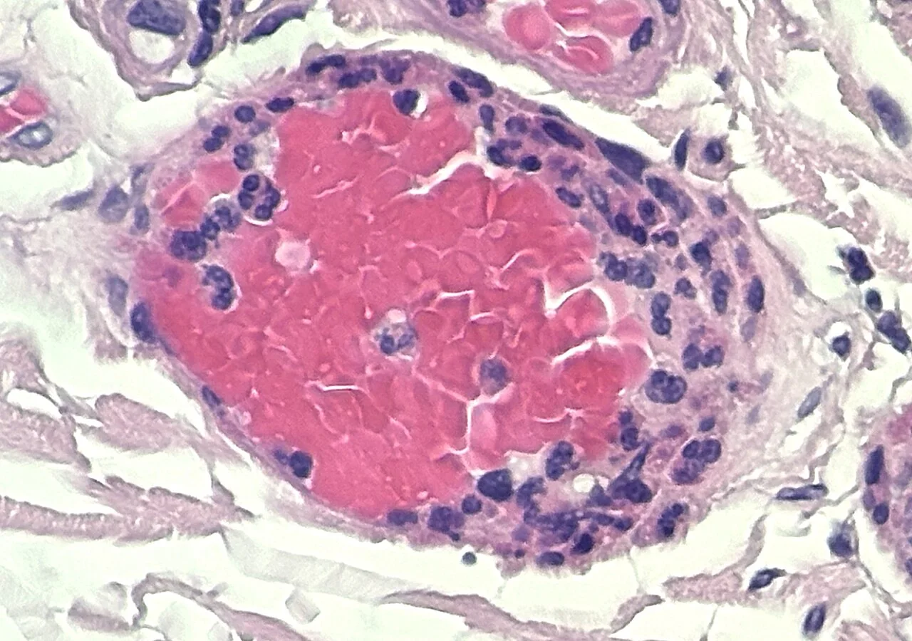 Histology of neutrophil margination